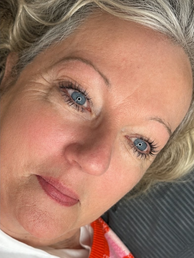 Resultaat van lippenpigmentatie