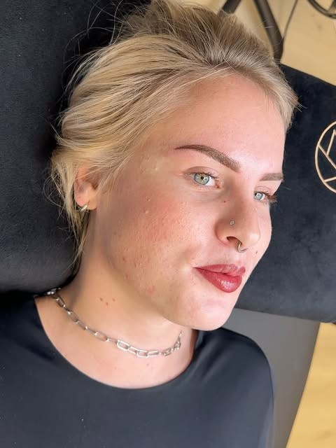 Lippenpigmentatie, klant op de behandelbank